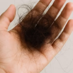 Hair fall solution