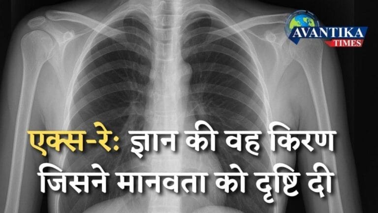 रेडियोग्राफी